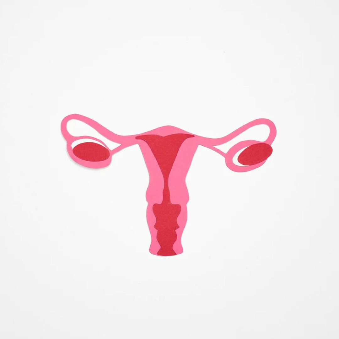 Ketogenic Diet & PCOS